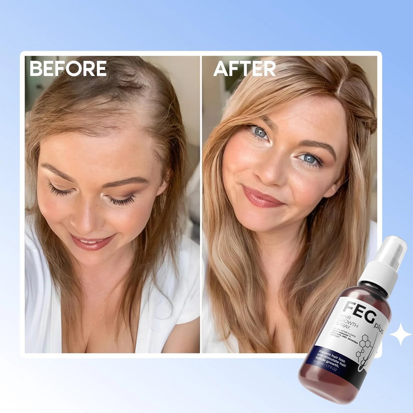 FEG Plus Hair Growth Spray 50ml | Natural Hair Care Spray for Stronger, Healthier Looking Hair| فیگ پلس ہیئر گروتھ اسپرے 50ml | گھنے، مضبوط اور صحت مند نظر آنے والے بالوں کے لیے قدرتی ہیئر کیئر اسپرے