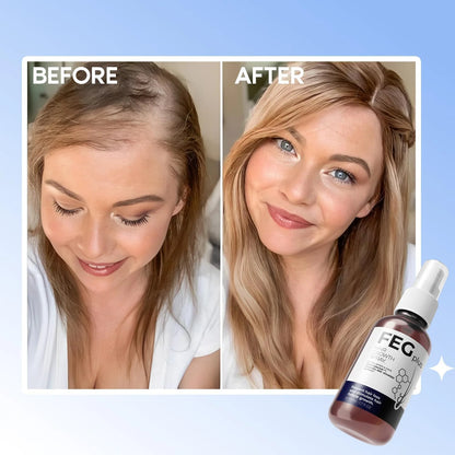 FEG Plus Hair Growth Spray 50ml | Natural Hair Care Spray for Stronger, Healthier Looking Hair| فیگ پلس ہیئر گروتھ اسپرے 50ml | گھنے، مضبوط اور صحت مند نظر آنے والے بالوں کے لیے قدرتی ہیئر کیئر اسپرے